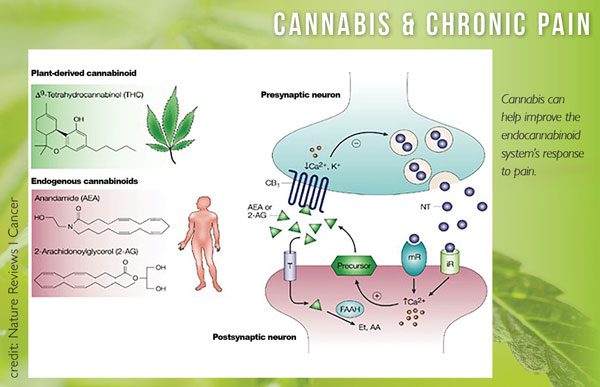 cannabis and chronic pain